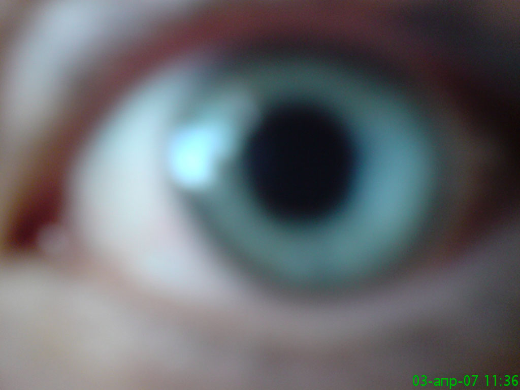 My eye :D